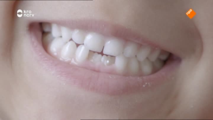 Kindertijd
