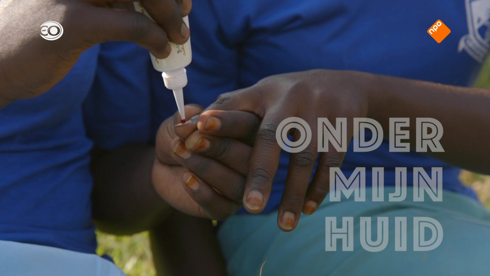 ZappDoc: Mensjesrechten  | Onder mijn Huid