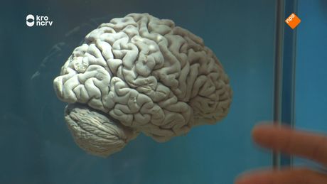 Willem Wever | Alzheimer