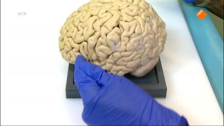 Het Klokhuis | Alzheimer