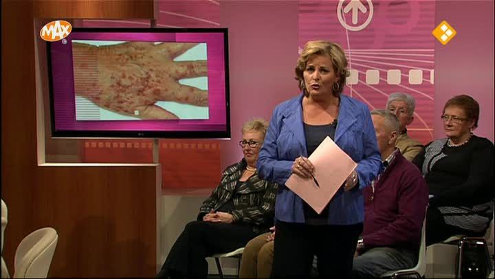 Ouderdomsvlekken en slapende banktegoeden