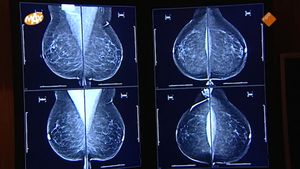 Strijd met ziekenhuis na gemiste diagnose